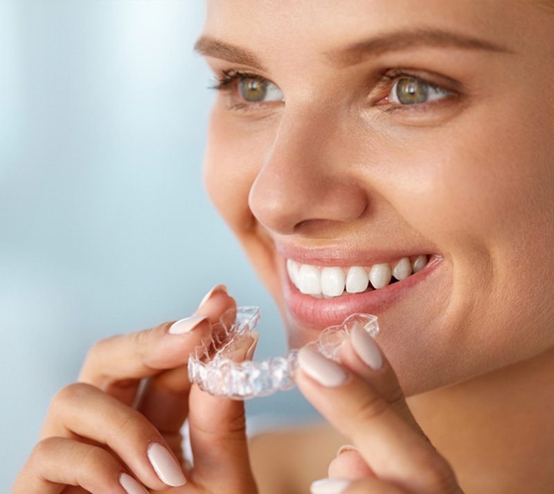 invisalign in downtown calgary
