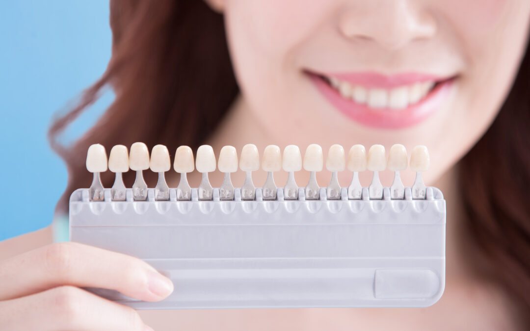 What Are Some Non-Cosmetic Reasons to Consider Veneers?